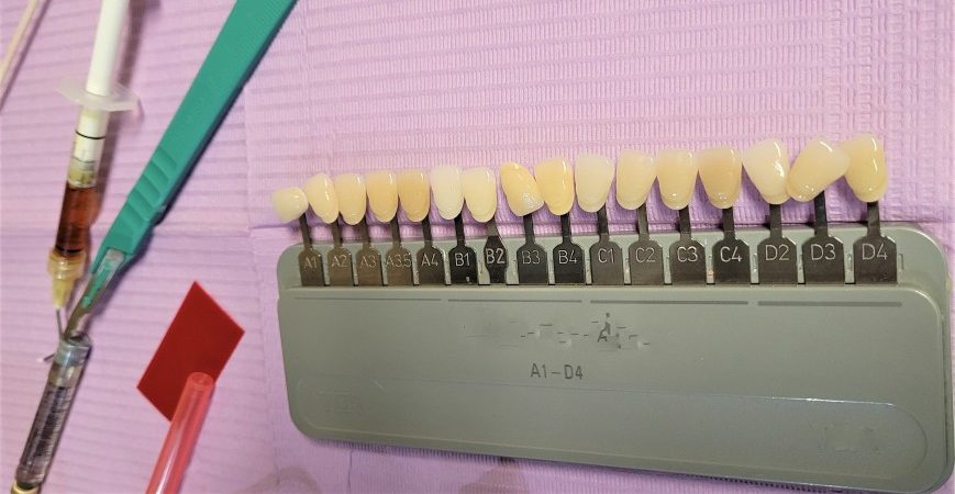 at-the-dentist-oral-healthcare-dental-tools-used-to-determine-the-tooth-color-of-the-porcelain-crown_t20_LJmwEY Dental care-Malaysia-dento